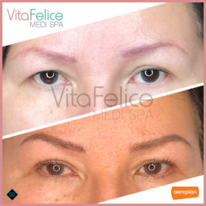 Lashes-Brows-and-Skin-transformation-Vancouver