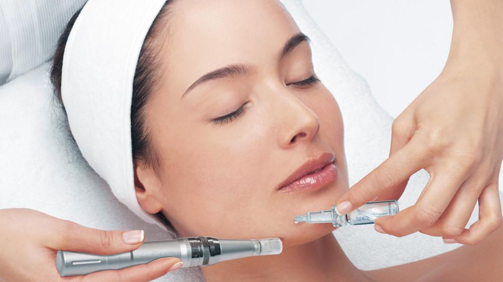 microneedling-anti-aging-acne-vita-felice-medi-spa-new-westminster