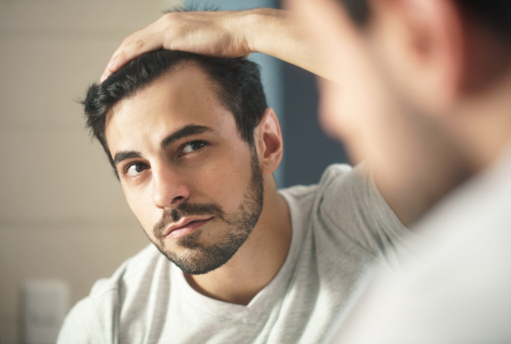 man worried for hair loss and looking at mirror his receding hairline