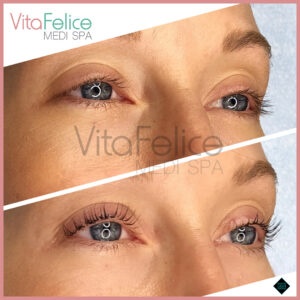 Keratin-Lash-Infusion-Treatment-in-New-Westminster