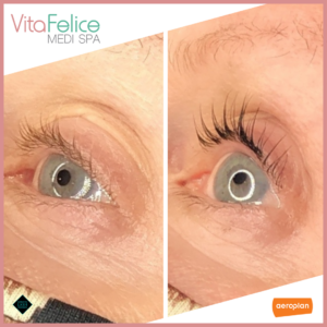 Keratin-Lash-Treatment-with-Lift-Tint-New Westminster