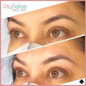 lash-lift-before-after-new-westminster