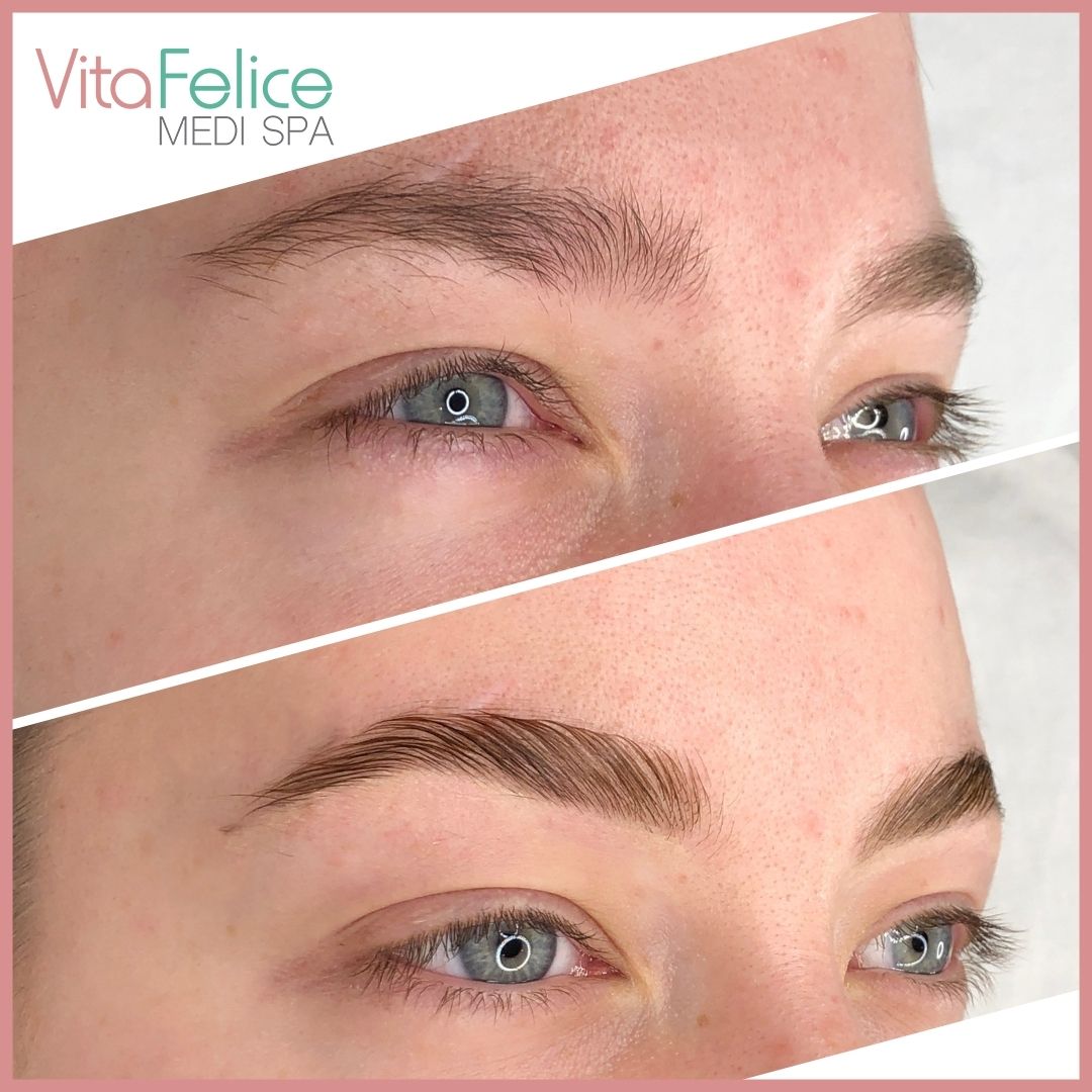 Brow laminaion & brow tint before and after New Westminster