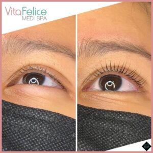 New Westminster lash lift and treatment