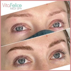Brow laminaion & Keatin Lash Lift Before After New Westminster