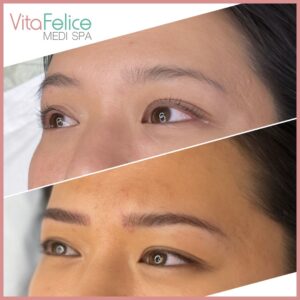 Nano Brows before and after New Westminster