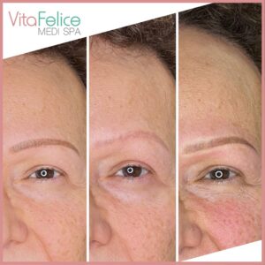 Powder Brows - Makeup - Before - After - Surrey