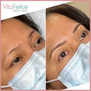 Powder Brows - Before and After - New Westminster