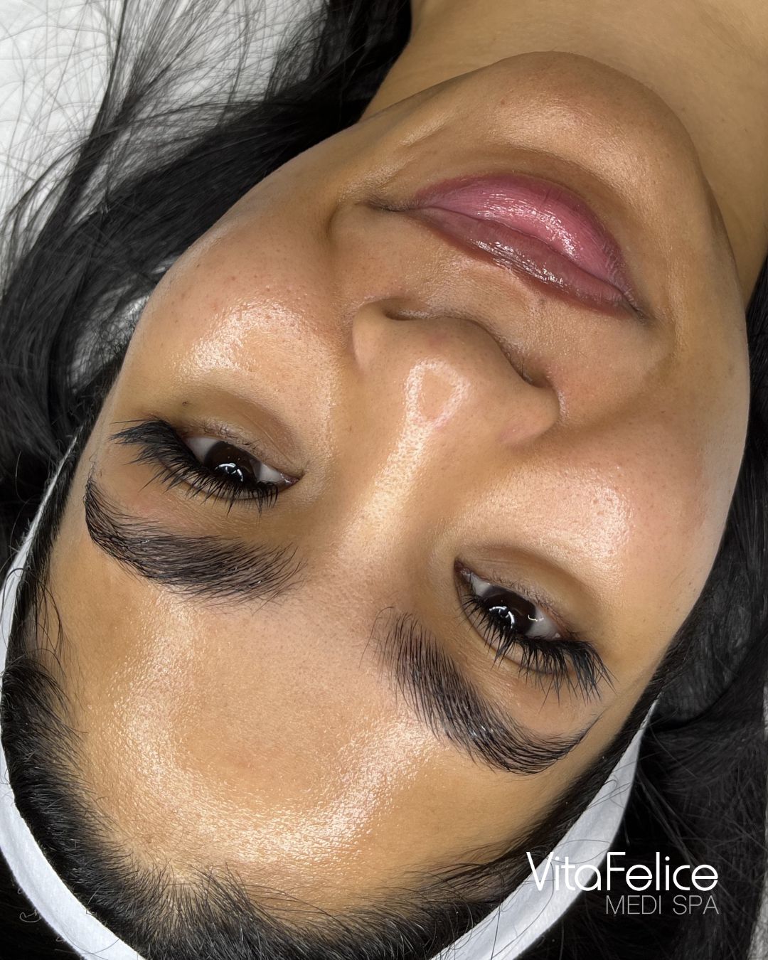 Sugaring Facial New Westminster