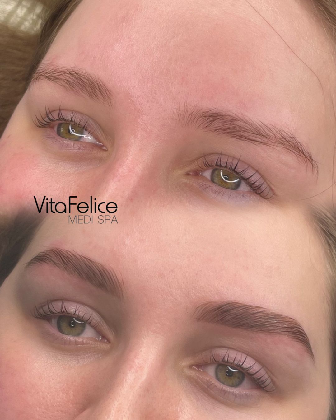 Brow Lamination New Westminster