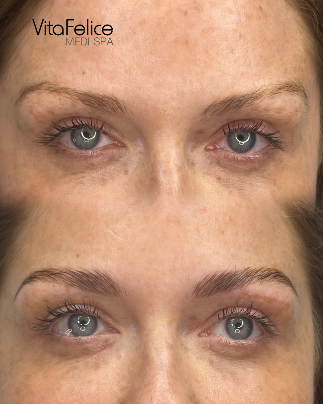 Brow Lamination - New Westminster
